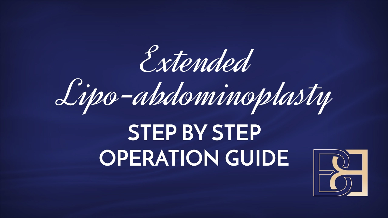 Extended Lipo-abdominoplasty: Step by Step Operation Guide
