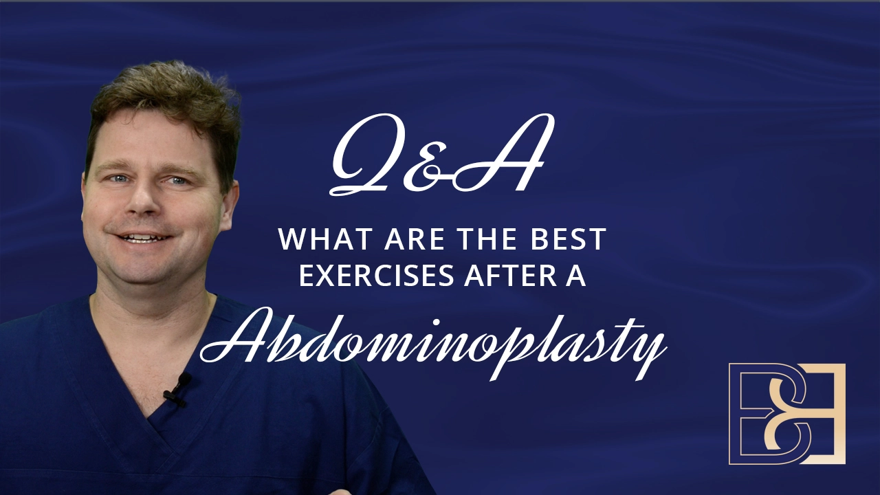 What Exercises can I do After an Abdominoplasty?