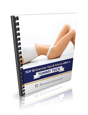Top 10 Exercise Tips and Advice After a Tummy Tuck
