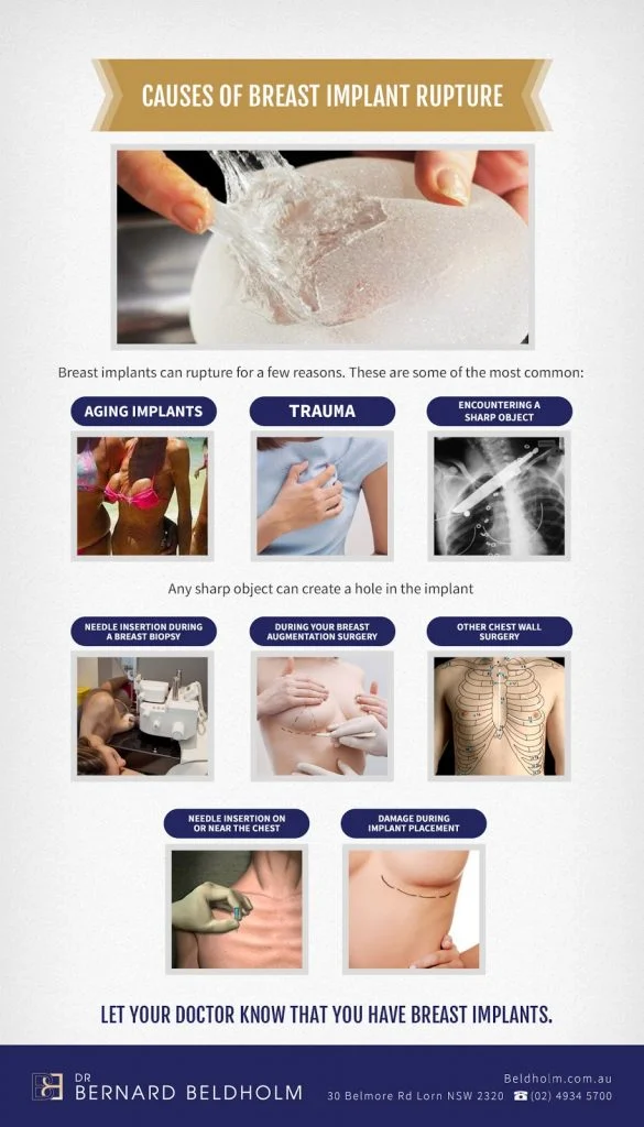 Causes of breast implant rupture