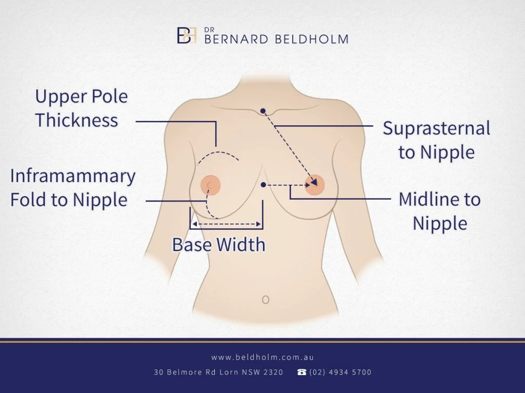 Dr. Beldholm Breast Measurement uncensored Infographic