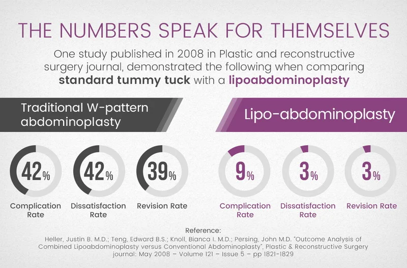 Standard Tummy Tuck and Lipo Abdominoplasty