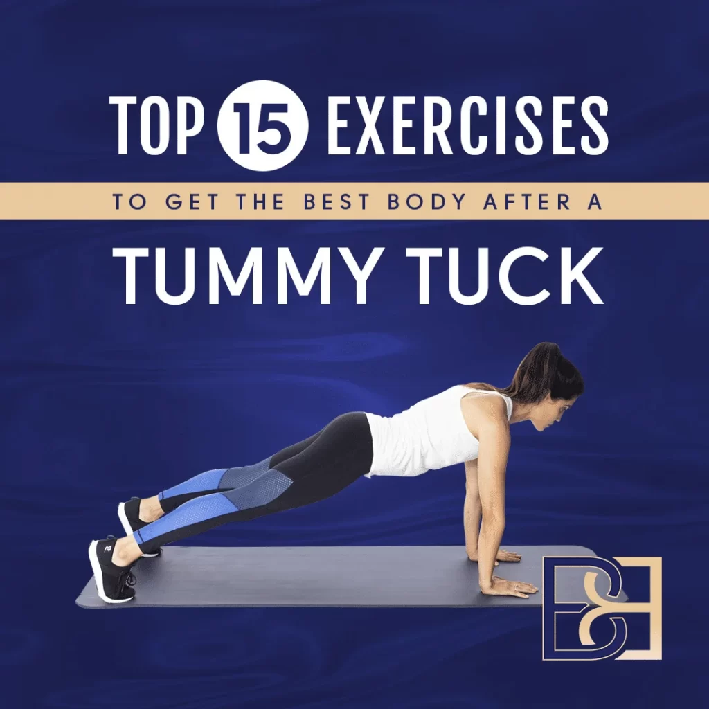 Top 15 Exercises After Tummy Tuck
