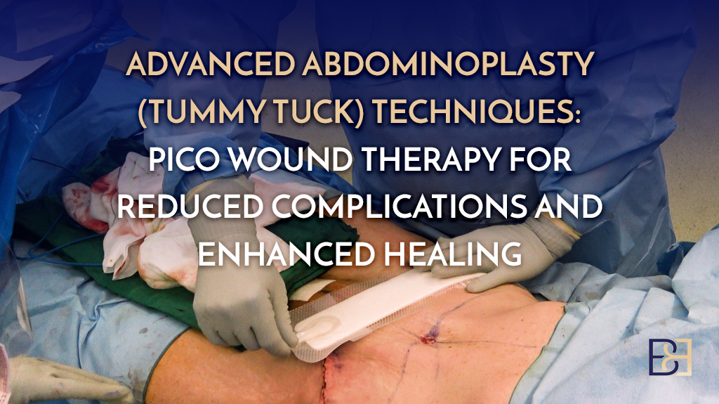 Advanced Abdominoplasty (Tummy Tuck) Techniques: PICO Wound Therapy for Reduced Complications and Enhanced Healing
