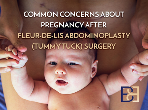 Common Concerns Surrounding Pregnancy and Fleur-De-Lis Abdominoplasty (Tummy Tuck) Surgery
