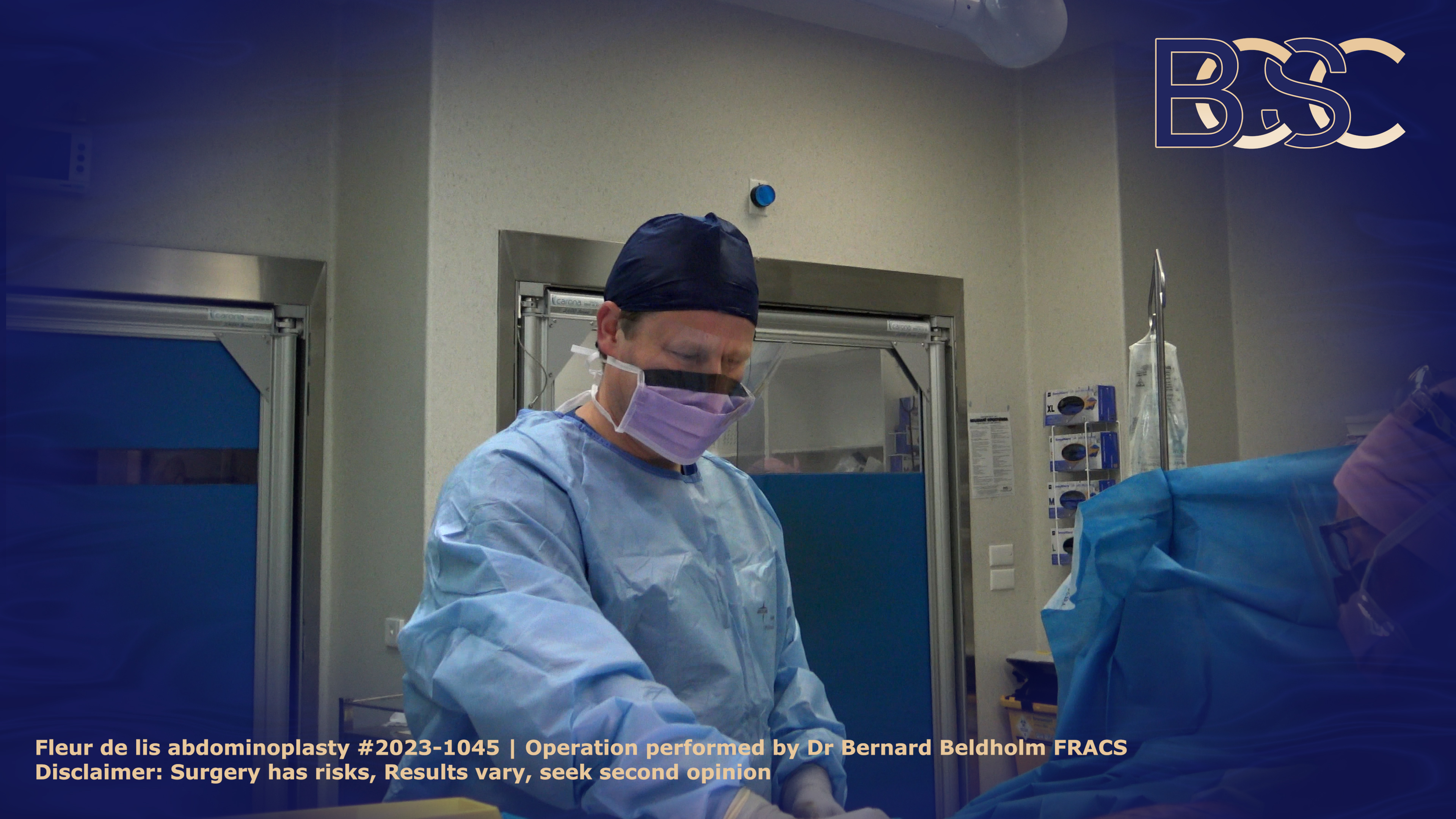 Dr Beldholm In operating theatre performing a Fleur de lis abdominoplasty | BB