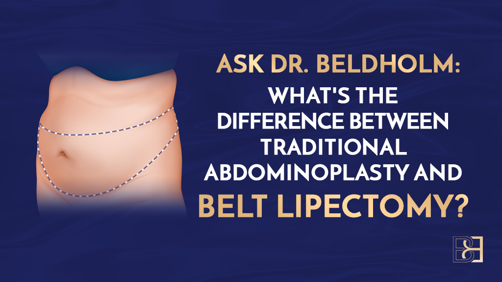 Ask Dr. Beldholm: What’s the Difference Between Belt Lipectomy and Abdominoplasty Surgery?