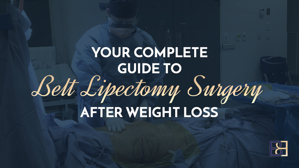 Your Complete Guide to Belt Lipectomy (Lower Body Lift) Surgery After Weight Loss