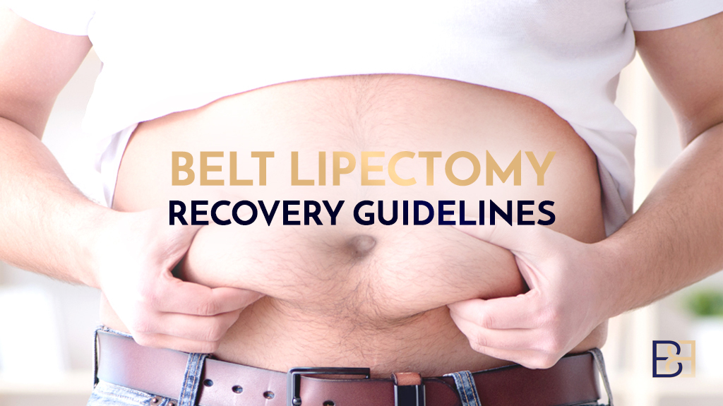 Belt Lipectomy Recovery Guidelines