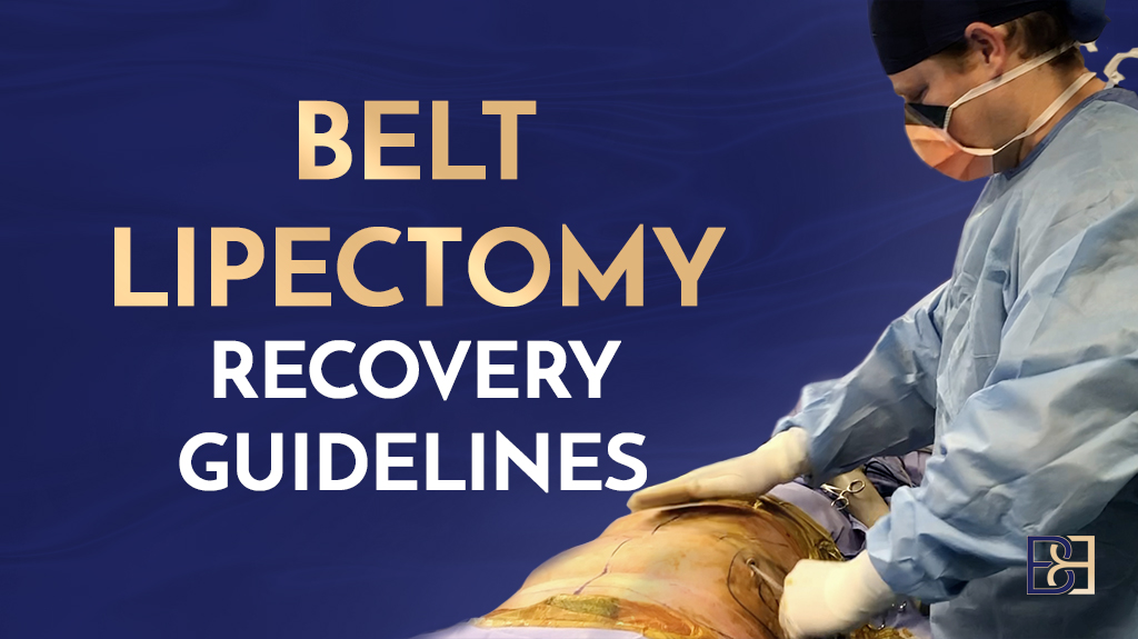 Belt Lipectomy Recovery Guidelines