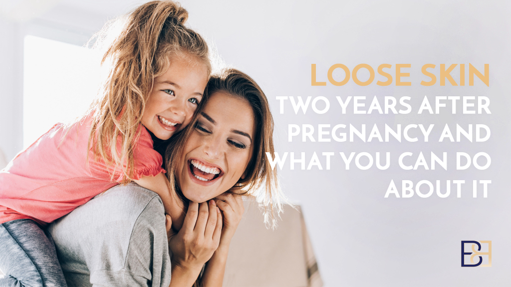 Loose Skin Two Years After Pregnancy and What You Can Do About It