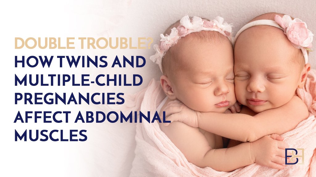 Double Trouble? How Twins and Multiple-Child Pregnancies Affect Abdominal Muscles