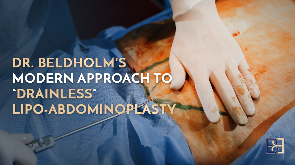 Dr. Beldholm’s Modern Approach to Drainless Lipo-Abdominoplasty