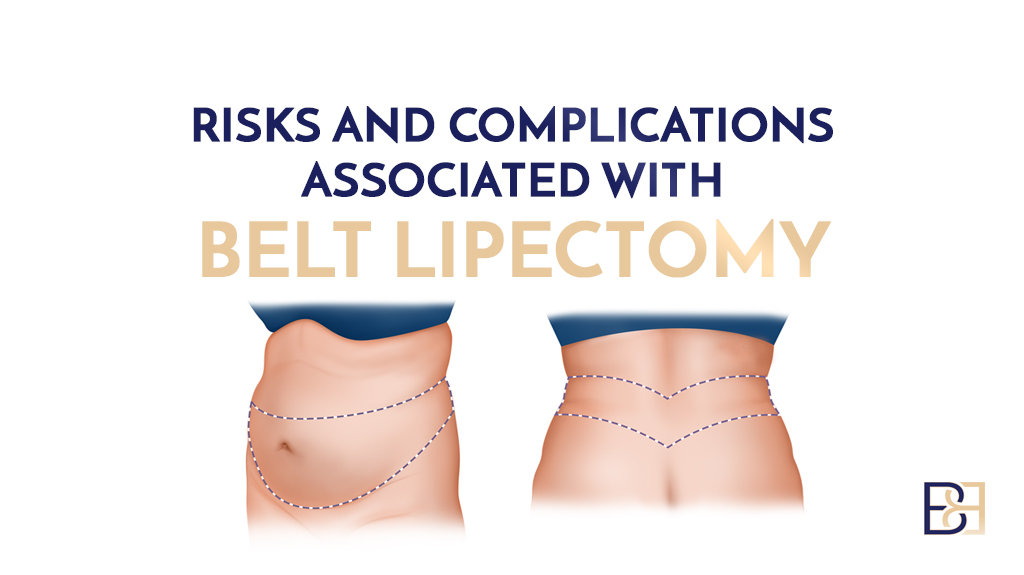 Risks Associated with Belt Lipectomy (Lower Body Lift)
