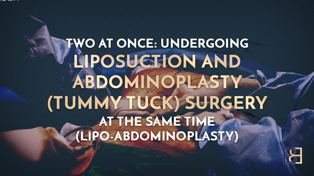 Two at Once: Undergoing Liposuction and Abdominoplasty (Tummy Tuck) Surgery at the Same Time (Lipo-Abdominoplasty)