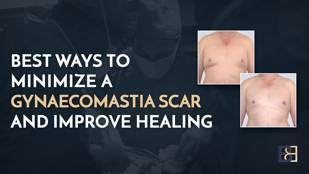 Best Ways to Minimize a Gynaecomastia Scar and Improve Healing