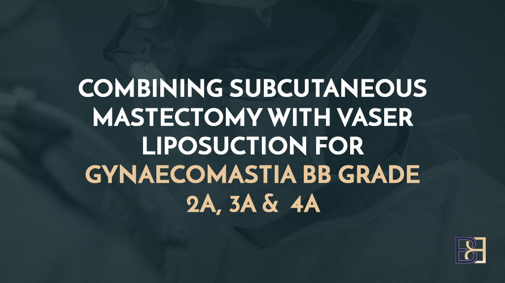 Combining Subcutaneous Mastectomy with VASER Liposuction for Gynaecomastia BB Grade 2a, 3a & 4a: Effective Male Breast Reduction Treatment