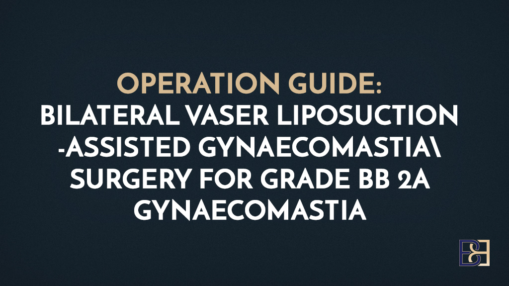 Operation Guide: Bilateral VASER Liposuction-Assisted Gynaecomastia Surgery for grade BB 2a gynaecomastia