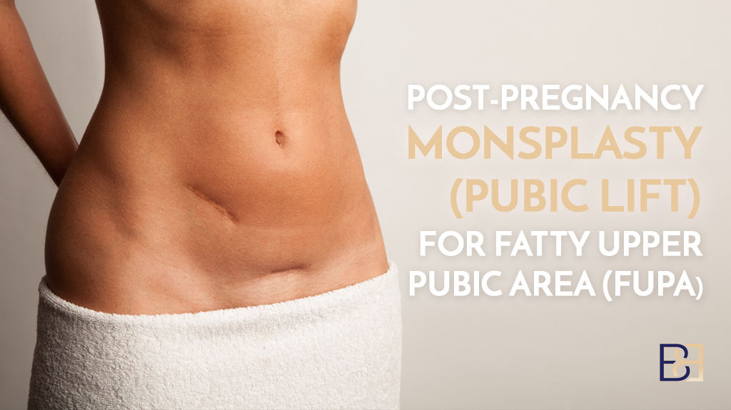 Post-Pregnancy Monsplasty (Pubic Lift) for Fatty Upper Pubic Area (FUPA)