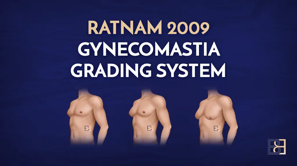 Ratnam 2009 Gynaecomastia Classification System