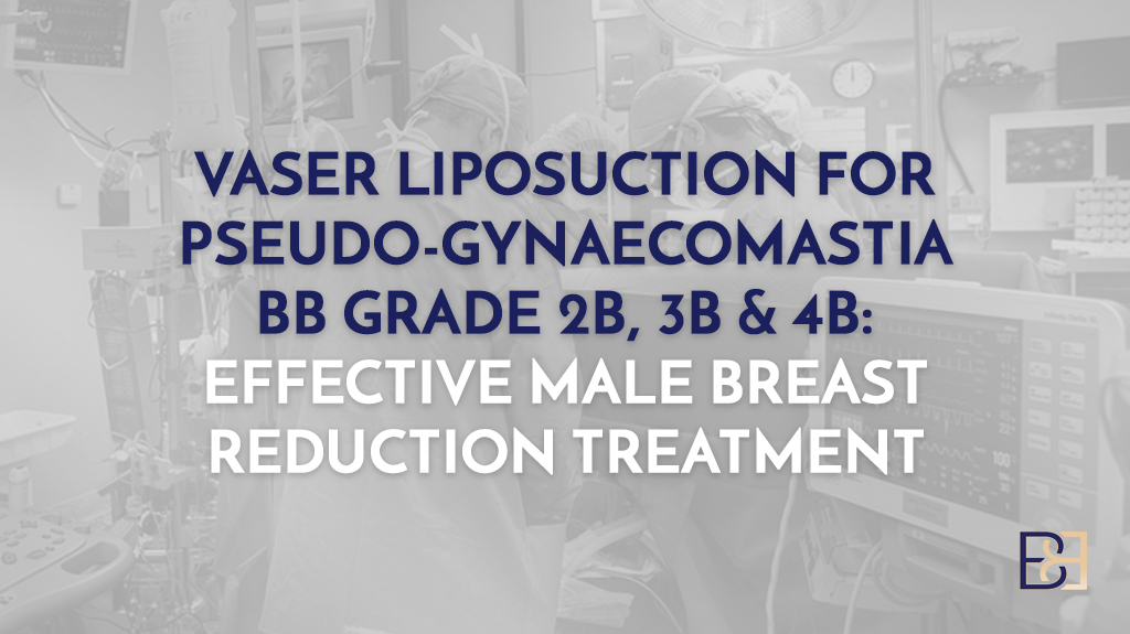 VASER Liposuction for Pseudo-Gynaecomastia BB Grade 2b, 3b & 4b: Effective Male Breast Reduction Treatment