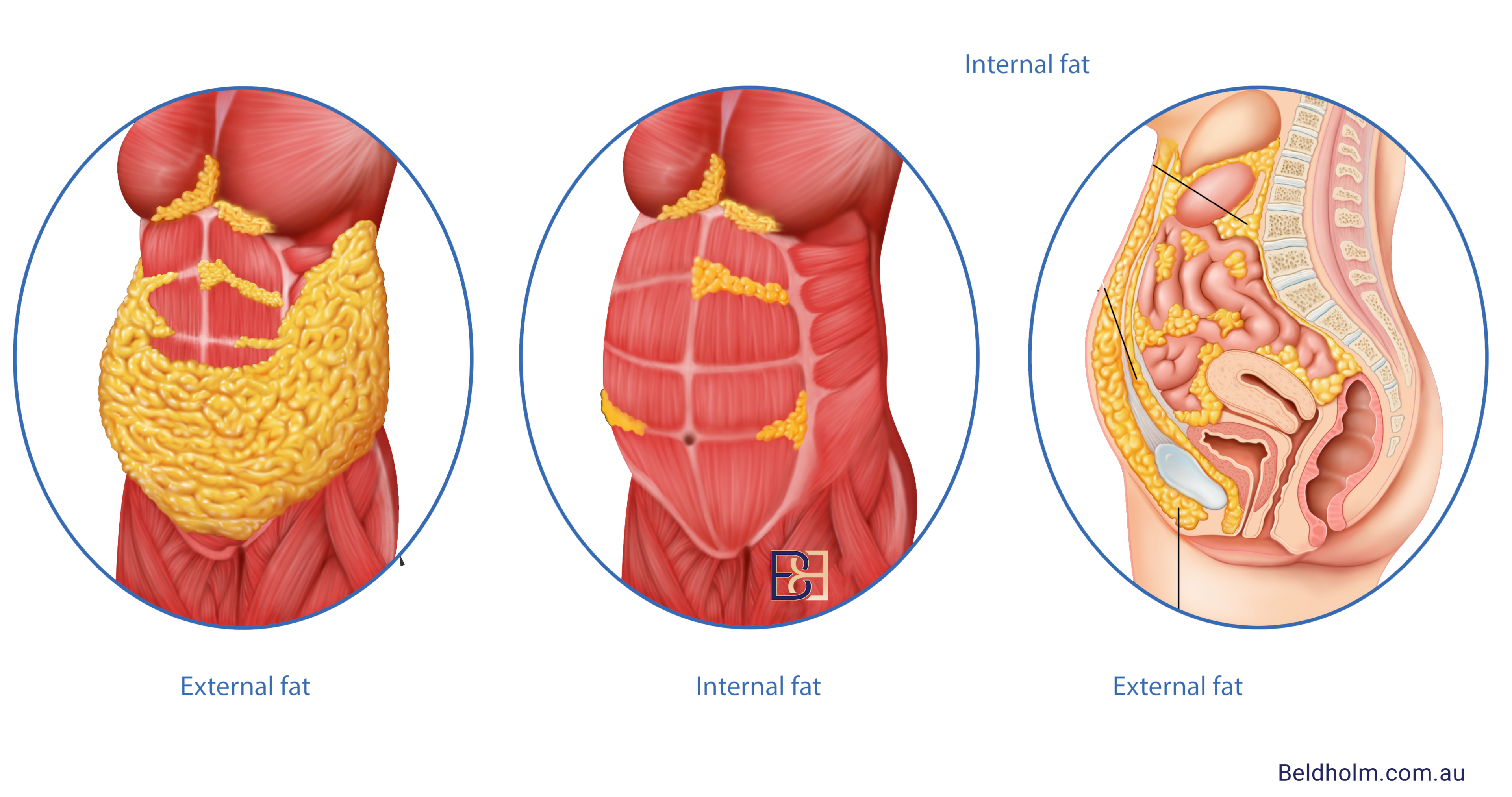 combined procedure for removing excess fat and skin