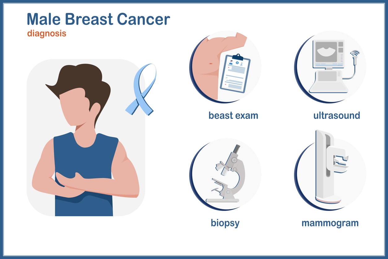 Male breast cancer diagnosis | Dr Beldholm