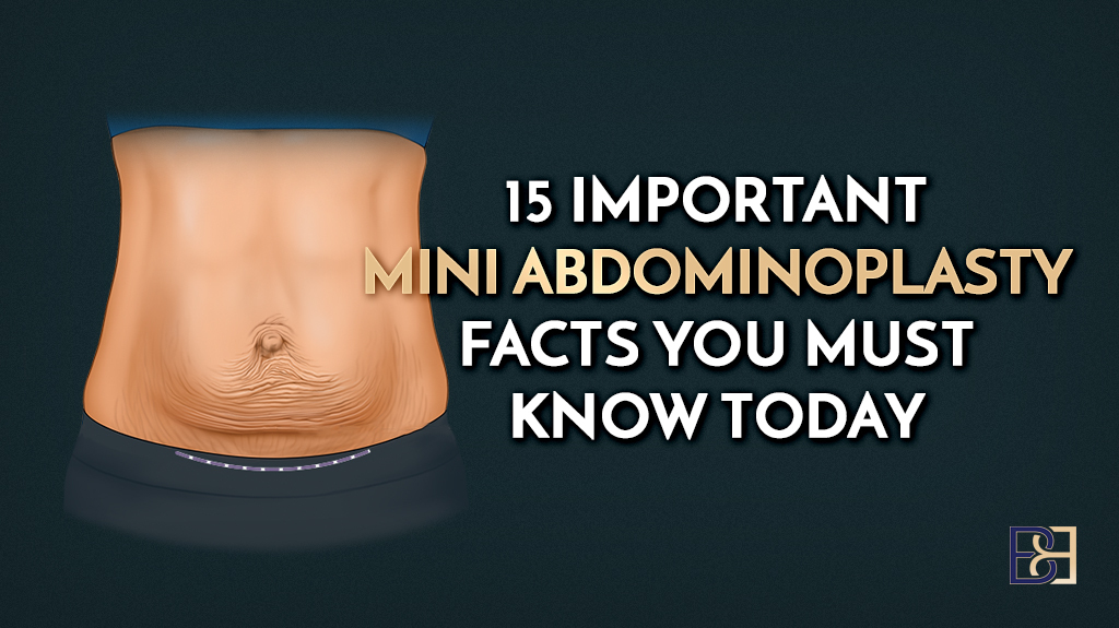 15 Important Mini Abdominoplasty Facts You Must Know Today