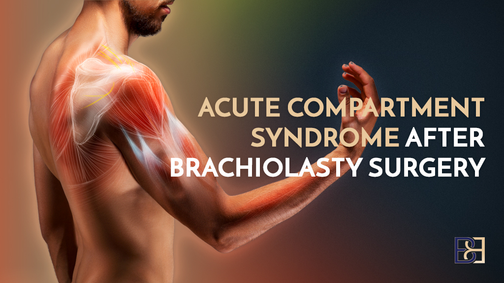 Acute Compartment Syndrome After Brachioplasty Surgery