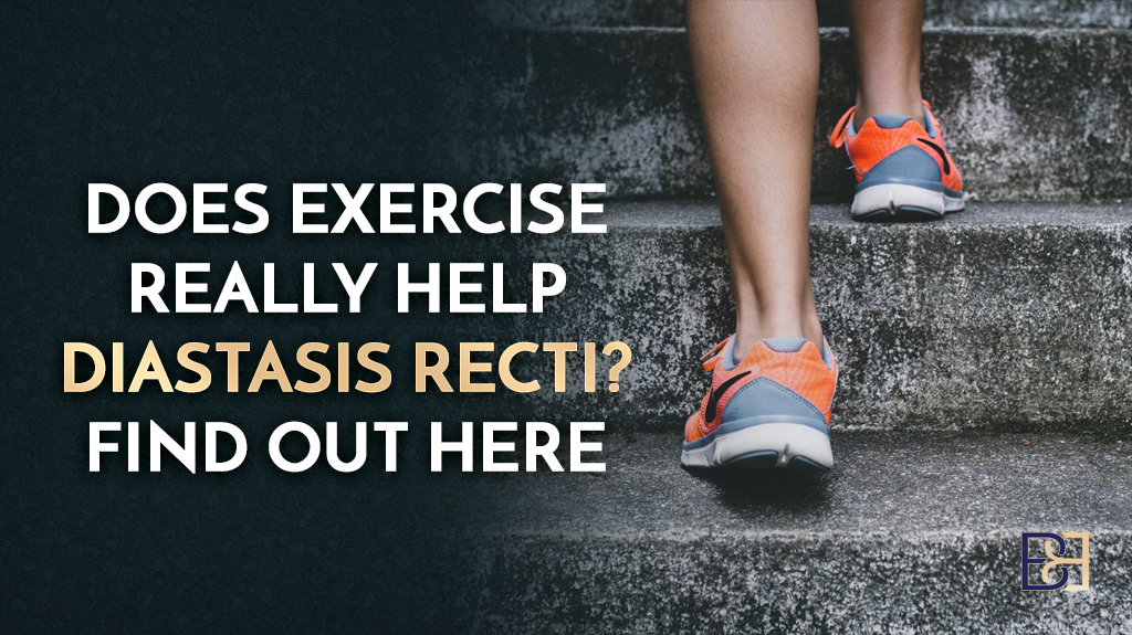 Does Exercise Really Help Diastasis Recti? Find Out Here