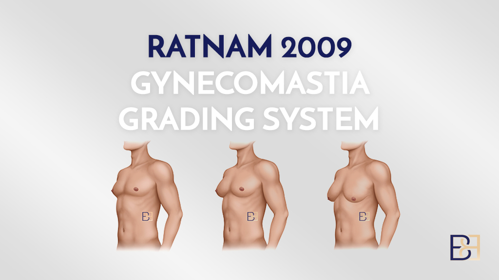 Ratnam 2009 Gynaecomastia Classification System