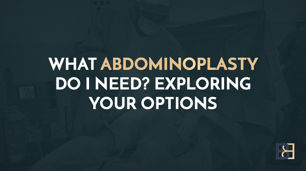 What Abdominoplasty Do I Need? Exploring Your Options