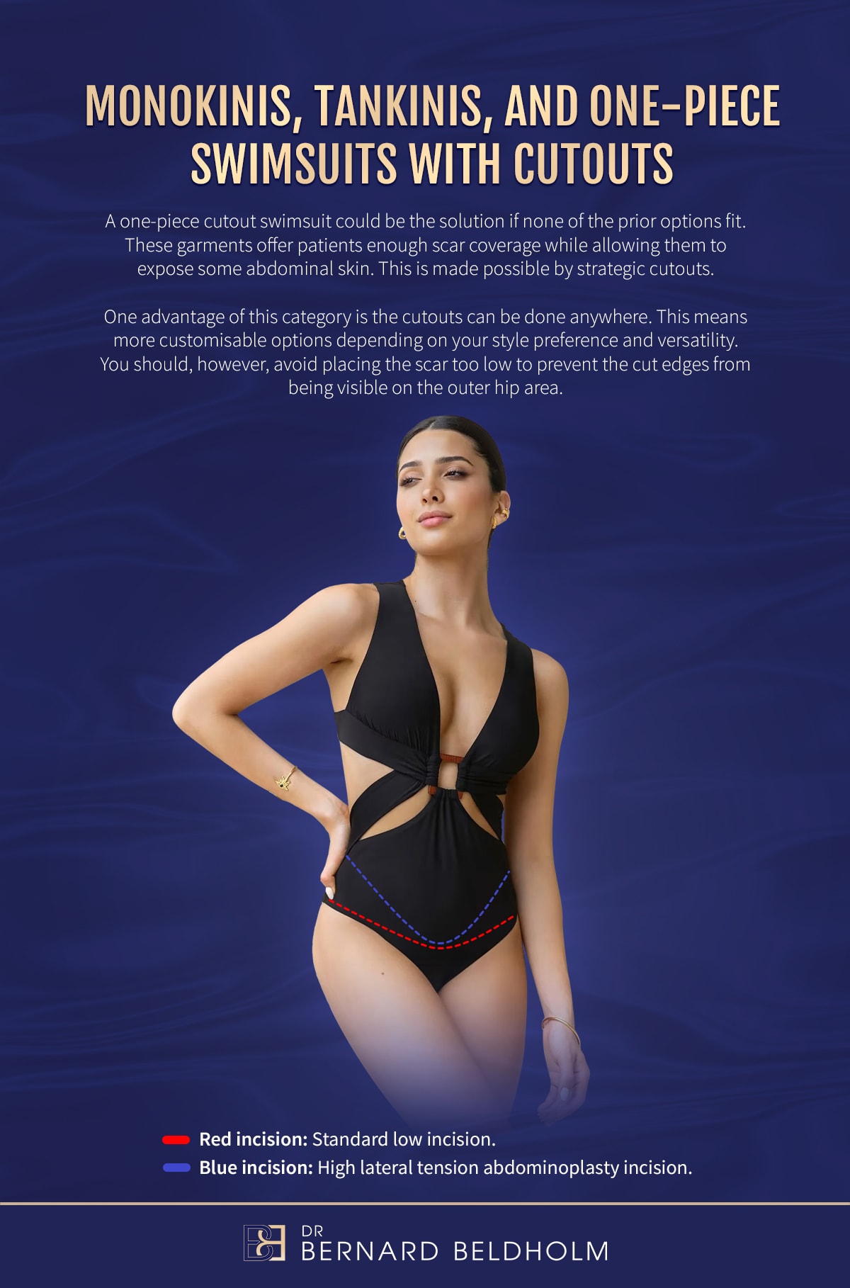 Monokinis, tankinis & one-piece swimsuits with cutouts