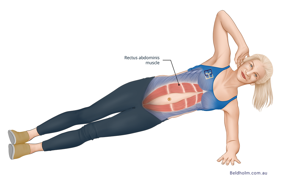 Rectus abdominis Muscle