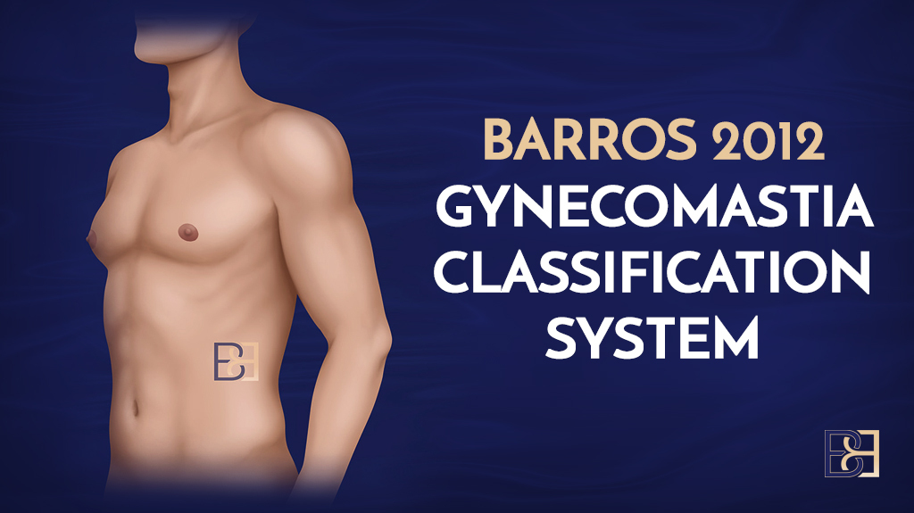 The Barros 2012 Gynaecomastia Classification System: Approaches for Evaluation and Therapeutic Solutions