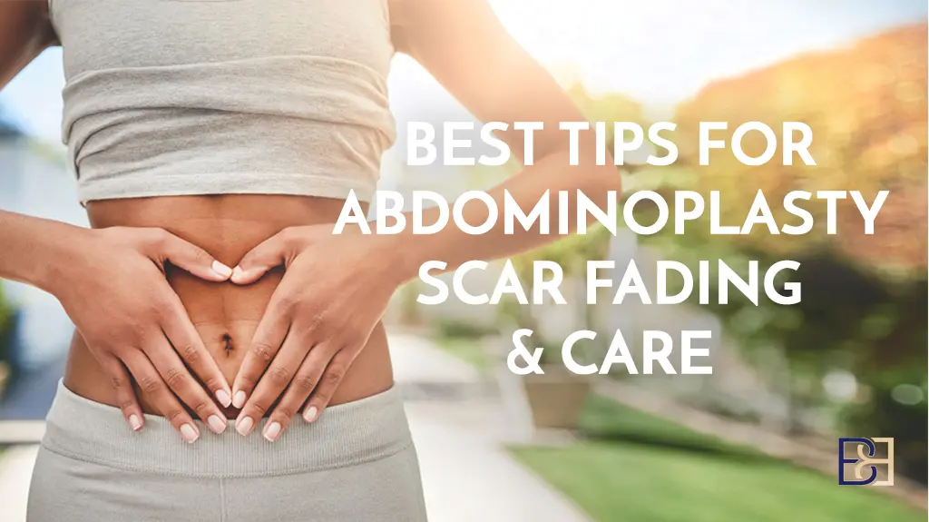 Best Tips for Abdominoplasty Scar Fading & Care