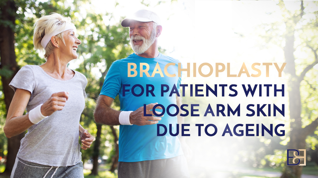 Brachioplasty for Patients with Loose Arm Skin Due to Ageing