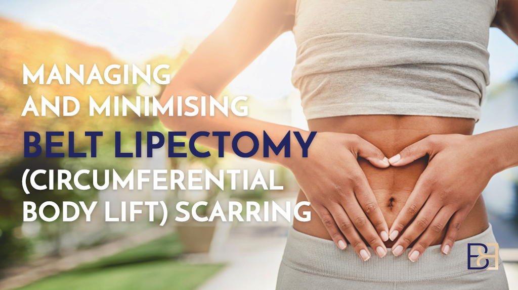 Managing and Minimising Belt Lipectomy Scarring (Circumferential Body Lift Scars)