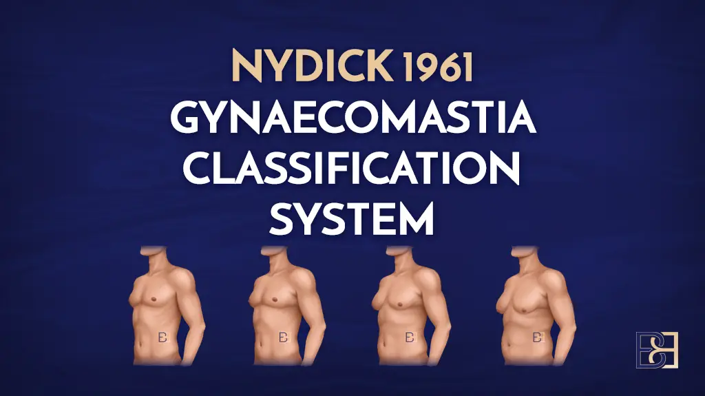 Nydick 1961 Gynaecomastia Classification System