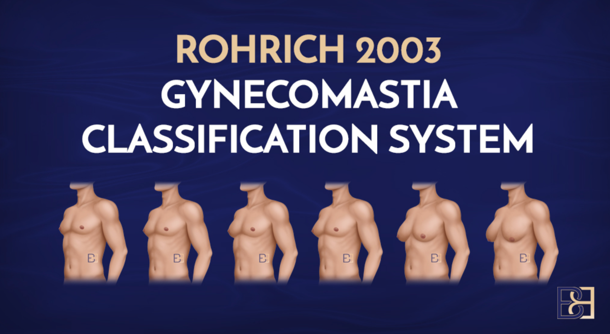 gynaecomastia surgery for breast tissue growth in men