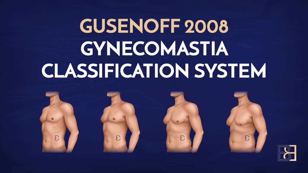 Gusenoff 2008 | dr beldholm