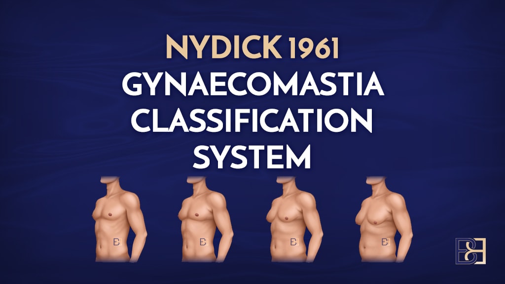 Nydick 1961 |dr beldholm