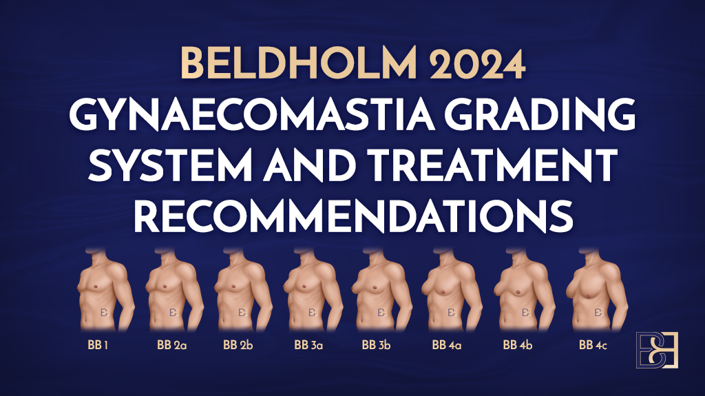 Beldholm 2024 Gynaecomastia Grading System and Treatment Recommendations