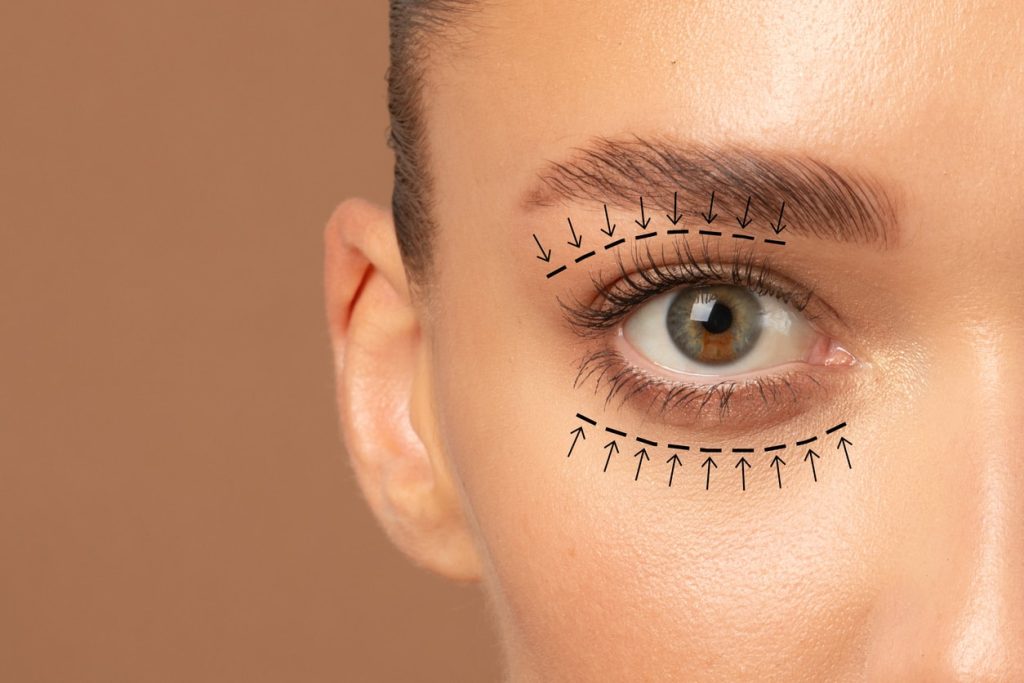 Understanding Blepharoplasty