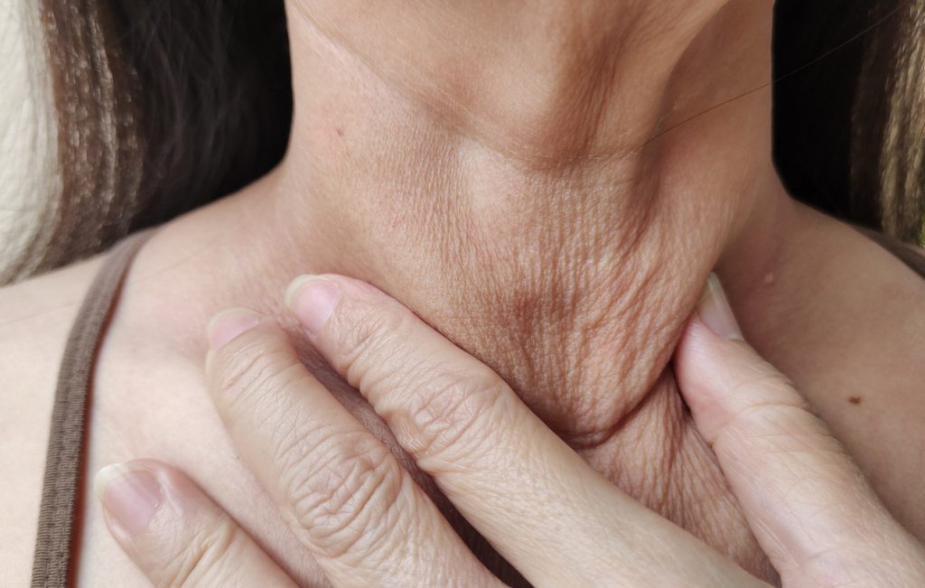 Platysmaplasty (Neck Lift) in Newcastle, Maitland & Hunter Valley Australia 1 iStock 1442140994