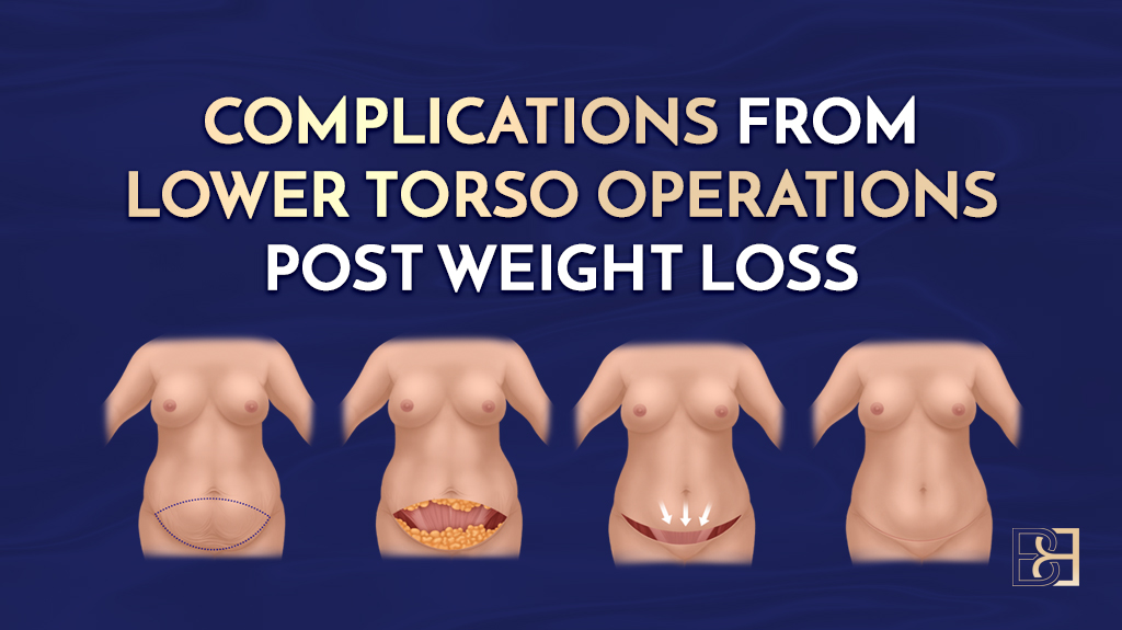 Complications from Lower Torso Operations Post Weight Loss