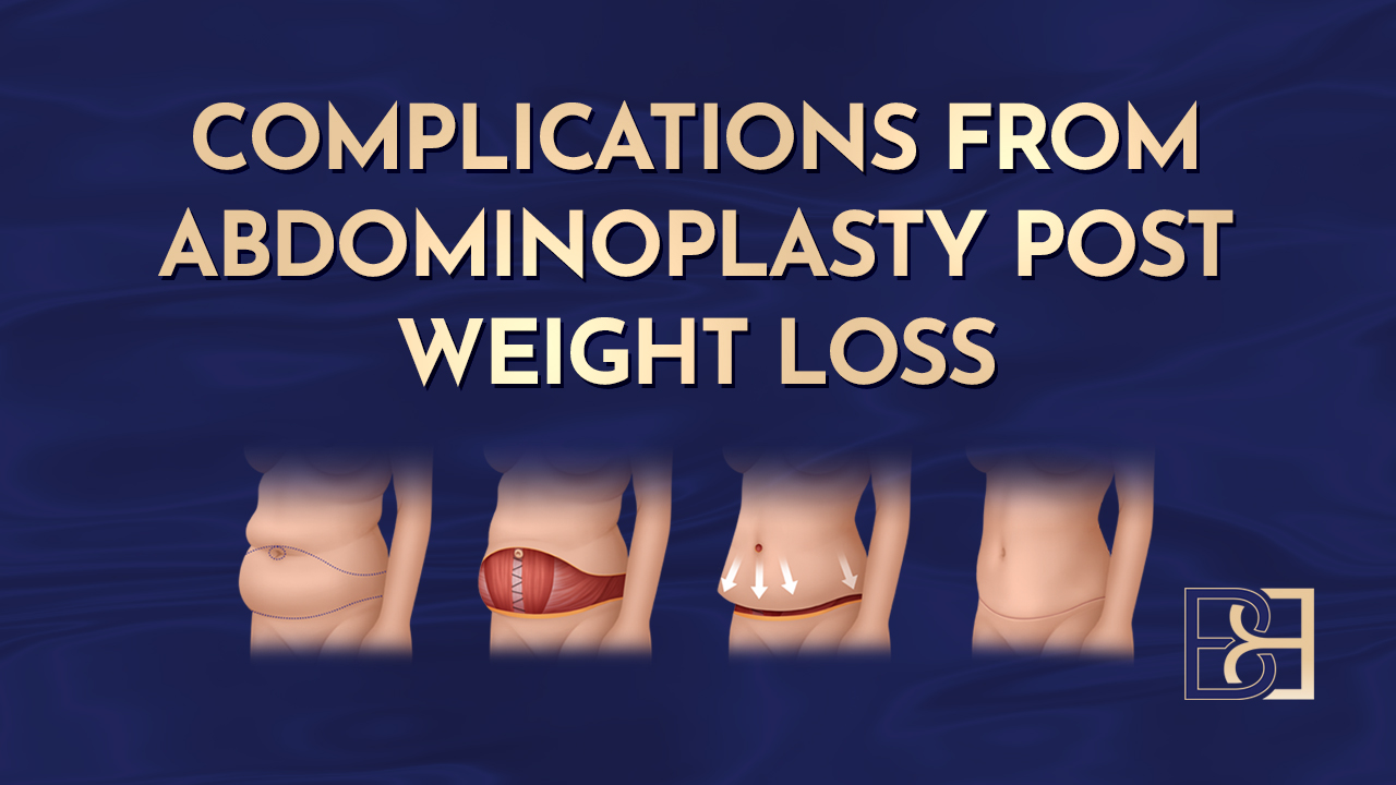 Overview of Complications from Abdominoplasty After Weight Loss