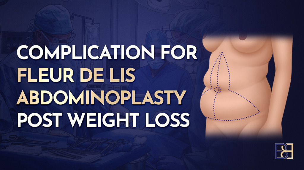 Complication for Fleur de Lis Abdominoplasty Post Weight Loss: Evidence-Based Insights from Recent Studies