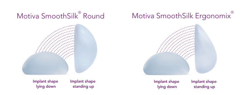 Guide to Motiva Breast Implants
