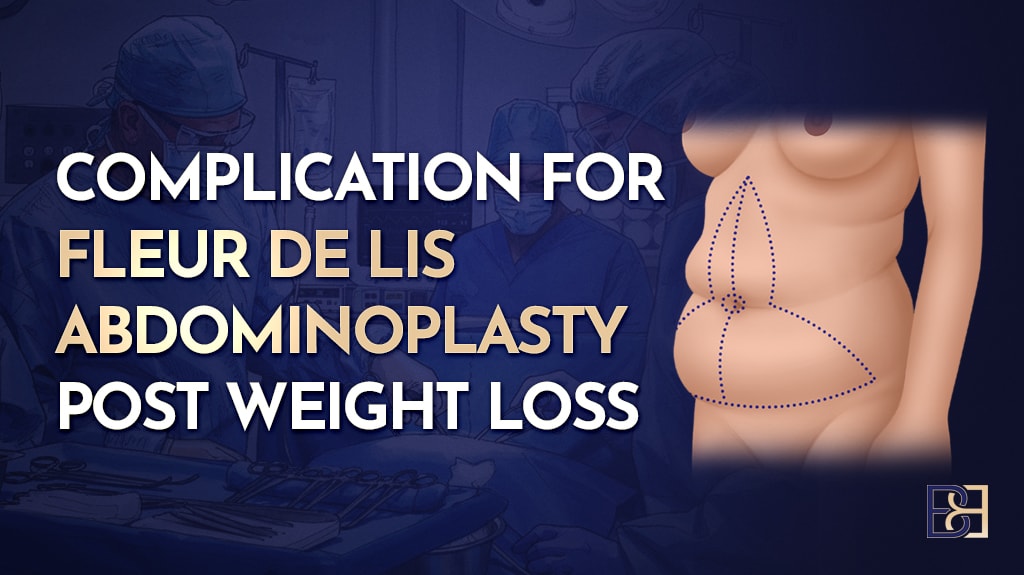 Complication for Fleur de Lis Abdominoplasty